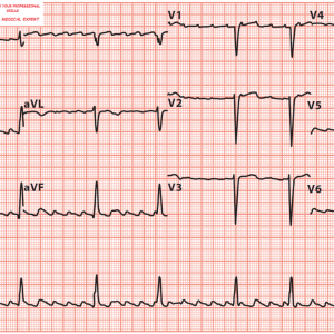 Curs Online EKG
