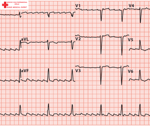 Curs Online EKG